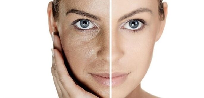 trước và sau khi trẻ hóa da mặt
